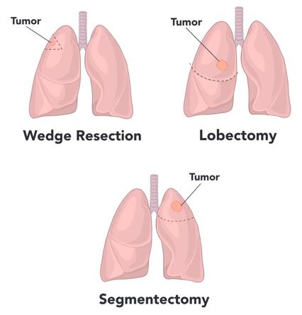 Understanding your operation