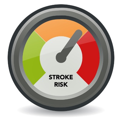 Stroke Risk Assessment